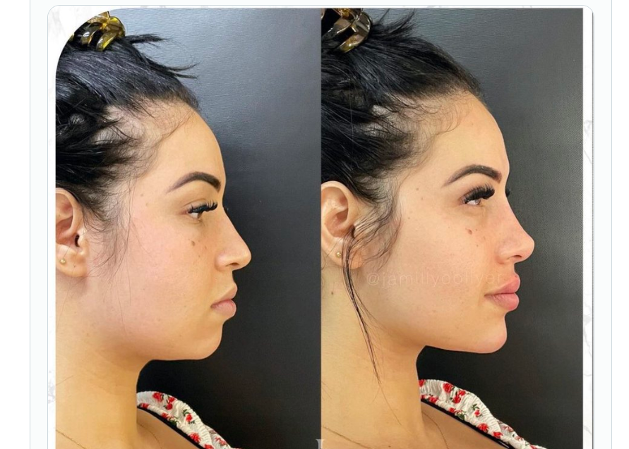 How to read before and after photos without being fooled